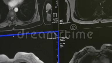 核磁共振扫描专业医疗设备上的脑部断层扫描。