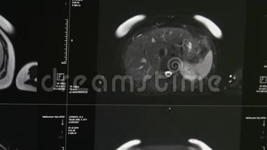 专业医疗设备MRI扫描的脑部断层扫描。