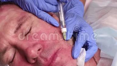 医生在病人脸上划了一个<strong>穴位</strong>`注射。 生物资本化的准备接近。