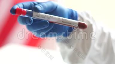 这项研究显示，一名戴着蓝色防护手套的微生物学家手中拿着血浆的试管的特写镜头