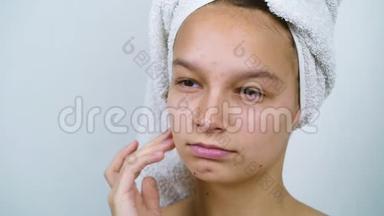 少女头上戴浴巾，脸上长痘痘