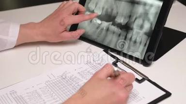 女牙医看着药片上的x光牙齿，填写检查表格。 关门