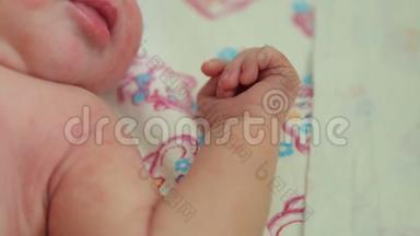 在医院的床上躺着一个<strong>皮肤过敏</strong>的新生儿的特写。